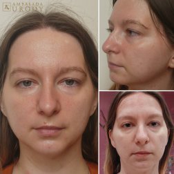 Beuty Tek, czyli medycyna cybernetyczna w Ambasadzie Urody #OkiemPacjenta