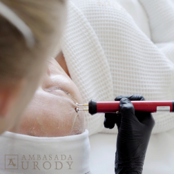 Skąd u nas opadające powieki?