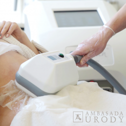 Jak trwale usunąć komórki tłuszczowe? Kriolipoliza w Ambasadzie Urody w Warszawie