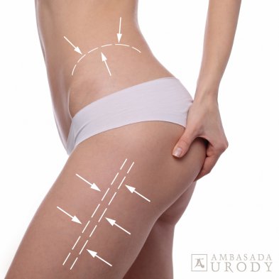 Jaki sekret pięknej figury ma Jessica Alba? - odchudzanie laserowe