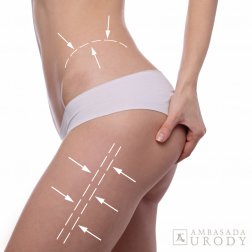 Jaki sekret pięknej figury ma Jessica Alba? - odchudzanie laserowe