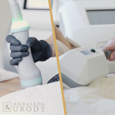 ONDA kontra Kriolipoliza — kiedy najlepiej je wykonywać?