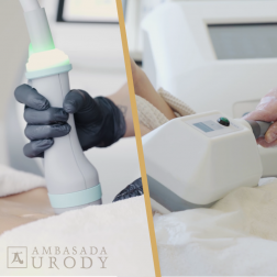 ONDA kontra Kriolipoliza — kiedy najlepiej je wykonywać?