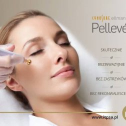 Termolifting Pelleve #okiempacjenta