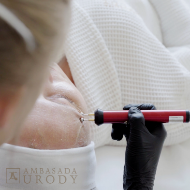 Technologia NASA w medycynie estetycznej? Poznaj BeautyTek