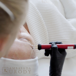 Technologia NASA w medycynie estetycznej? Poznaj BeautyTek