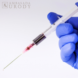 Jakie zabiegi stosuje Kim Kardashian? Na czym polega wampirzy lifting?