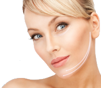 First lift <br>nici liftingujące