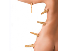 termolifting zaffiro