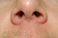 Rumien i&nbsp;Zmiany Naczyniowe