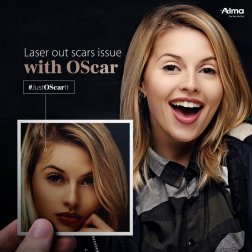 Hybrid OScar - najskuteczniejsza metoda leczenia blizn