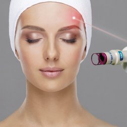 Laser frakcyjny CO2 - Odmładzanie, usuwanie zmarszczek i lifting skóry