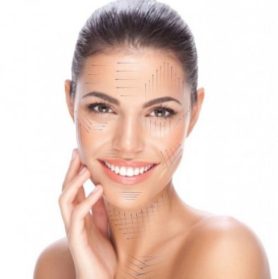 Nici liftingujące z kwasu polimlekowego -20%