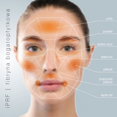 Fibryna bogatopłytkowa do -20% Odbudowa struktury skóry
