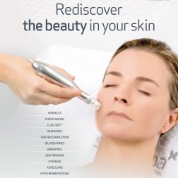 Mezoterapia mikroigłowa z kwasami i czynnikami wzrostu -20%