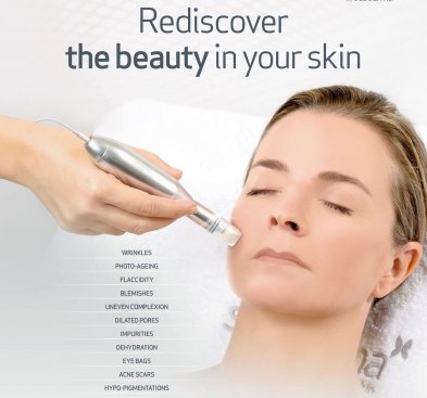 Mezoterapia mikroigłowa z kwasami i czynnikami wzrostu -20%