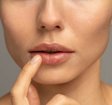 Powiększanie i modelowanie ust kwasem hialuronowym -20%